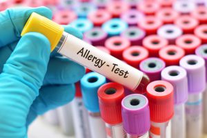 血液検査でアレルギー性鼻炎の原因物質を調べる